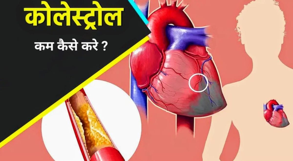 cholesterol कैसे कम करे? कोलेस्ट्रॉल कम करने का नैचुरल उपाय 2024