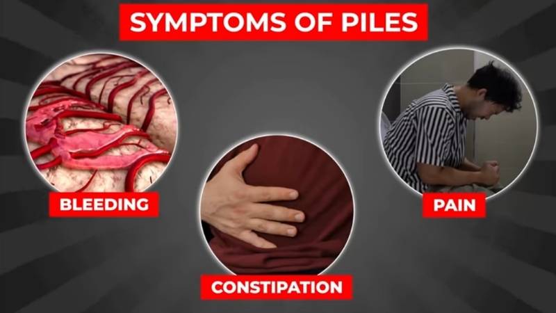 क्या पाइल्स में हर फल खाना सही होता है? 5 Worst Fruits for Piles 2 क्या पाइल्स में हर फल खाना सही होता है? 5 Worst Fruits for Piles